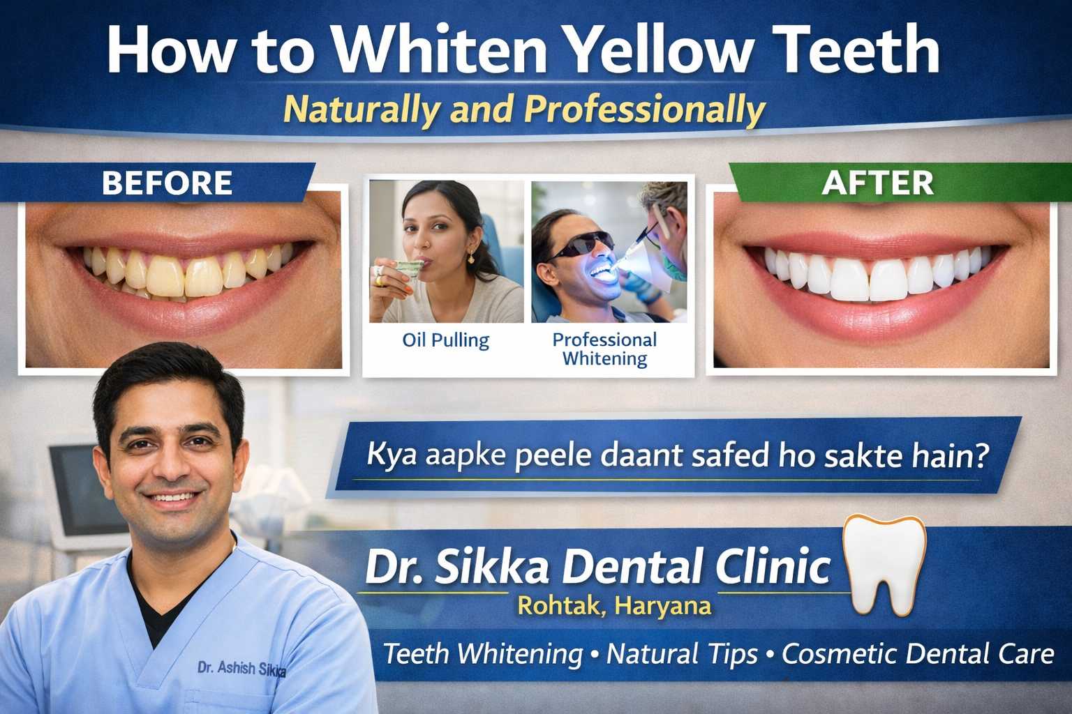 How to Whiten Yellow Teeth Naturally and Professionally